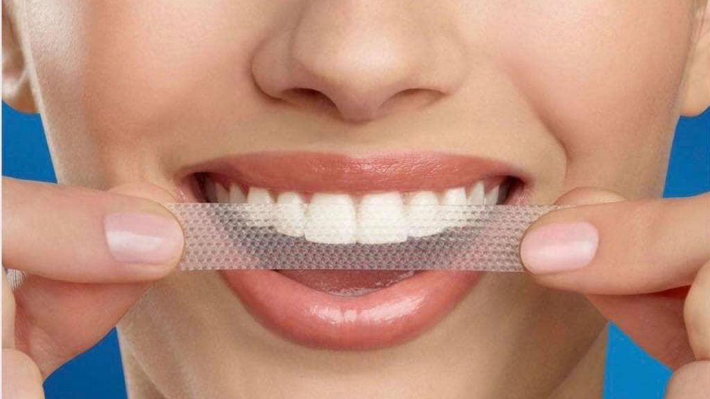Ẩn họa từ các sản phẩm trắng răng siêu tốc