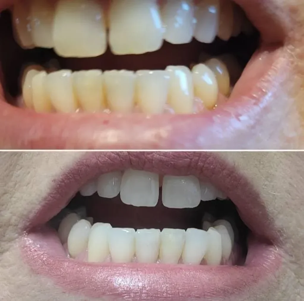 Nếu bạn đang tìm kiếm các mặt hàng làm đẹp hoàn hảo thì đây là danh sách không thể bỏ qua 1